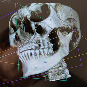 CTImagingTechnologyCanImproveOutcomesforComplexDentalProblems