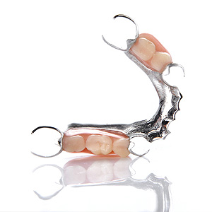 RPDsOfferAnotherToothReplacementOptionforthoseonaTightBudget