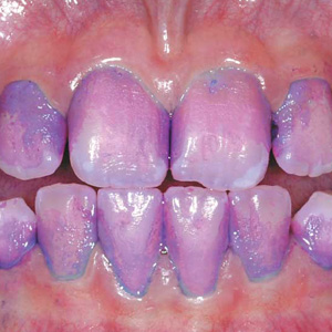 UseThisProducttoCheckYourBrushingandFlossingEffectiveness