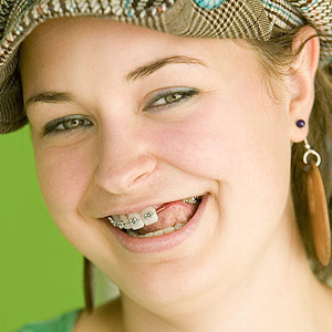 TimingisEverythingWhenReplacingaTeenagersMissingTooth