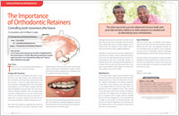 Orthodontic Retainers - Dear Doctor Magazine
